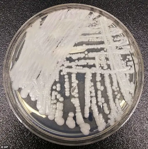 Deadly, Treatment-Resistant Fungus Spreading Rapidly in Hospitals: CDC Issues Urgent Threat Alert as Crisis Escalates