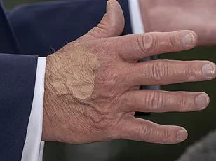 Privileged Access to Health Advice: Trump's Defiance of Medical Warnings