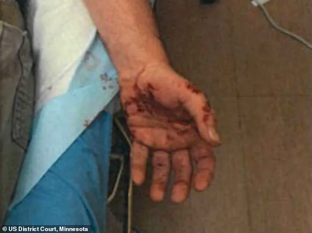 Previously Hidden Injuries of ICE Agent Resurface Amid Fatal Shooting Controversy