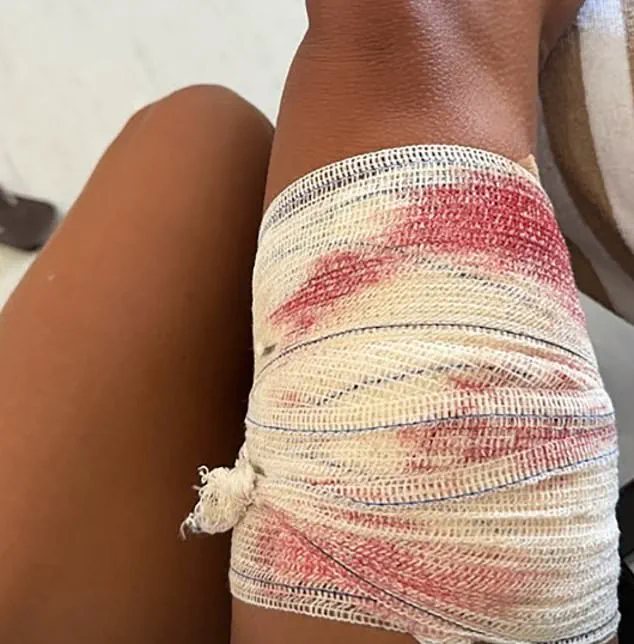 Urgent: Nurse Shark Attack Injures Snorkeler at Brazil's UNESCO Site Fernando de Noronha