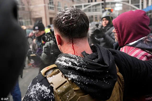 Conservative Lawmaker Injured in Minneapolis Protest Sparks Debate on Political Rhetoric and Polarization