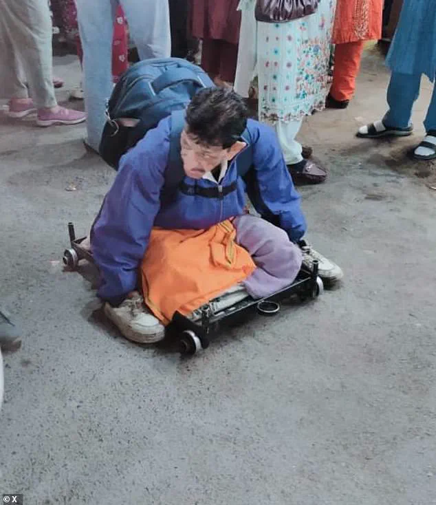 A Man's Struggle in Indore: The Invisible Challenges of Urban Disability