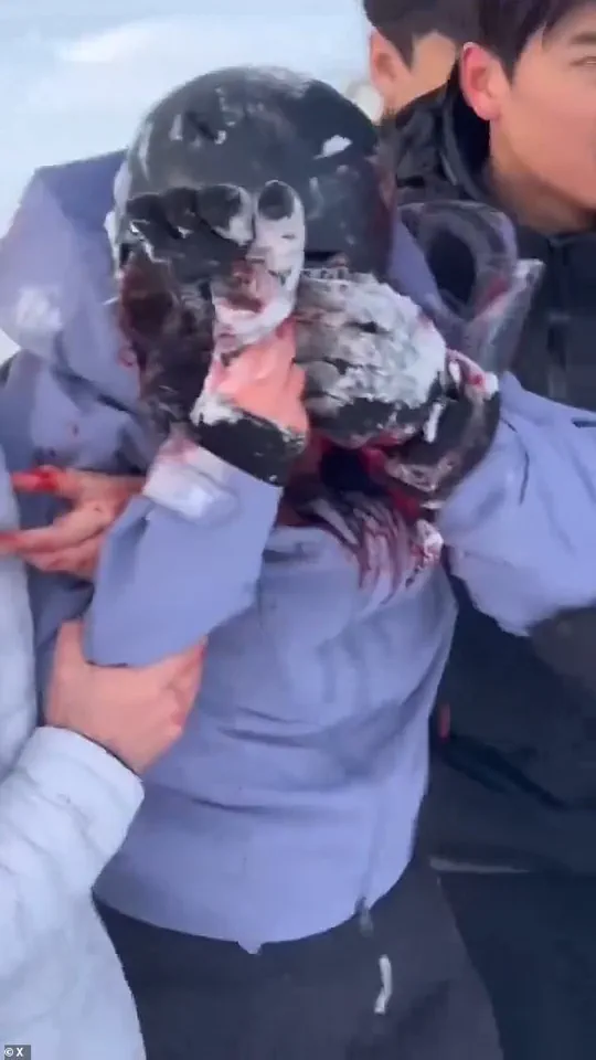 Snow Leopard Attack Injures Tourist in China's UNESCO Geopark, Highlighting Wildlife Risk