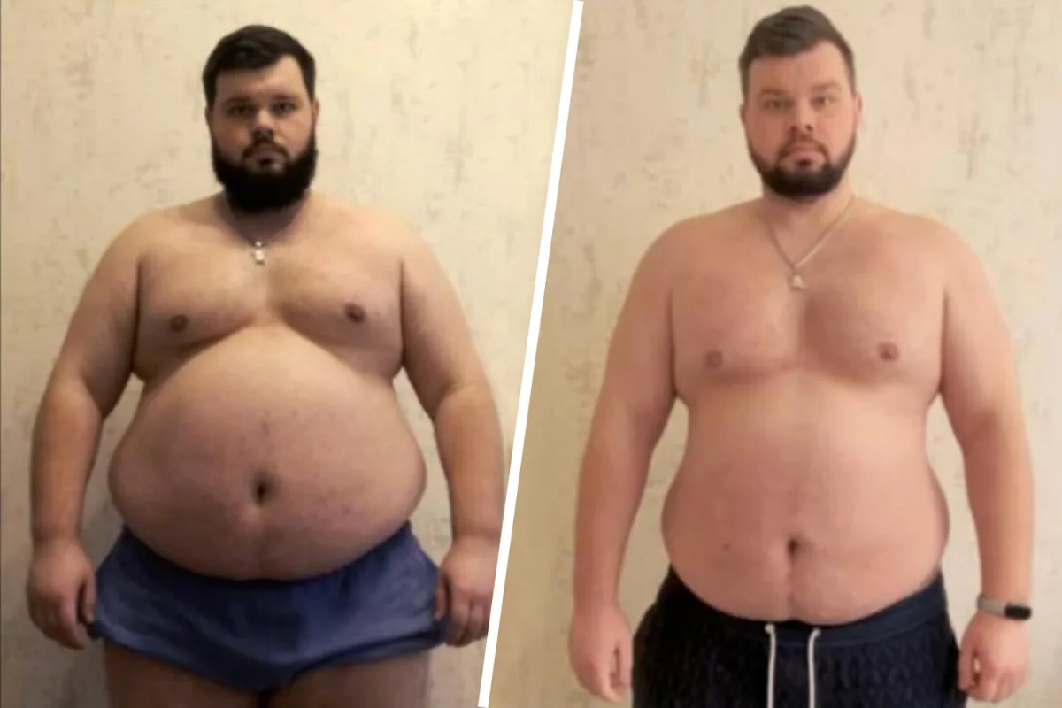 Ukrainian Man with Obesity Forcibly Mobilized, Raising Health and Rights Concerns