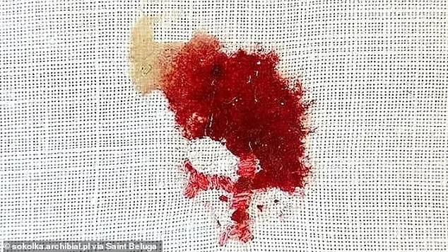 Faith vs. Forensics: The Unexplained Mystery of Communion Transformation