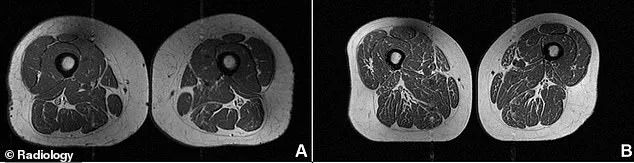 The Dark Side of Ultra-Processed Foods: Disturbed Imagery Reveals Health Risks.
