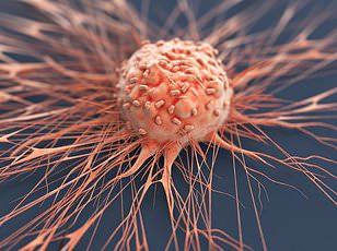 Woman faces tongue loss after mystery mouth ulcers reveal oral cancer.