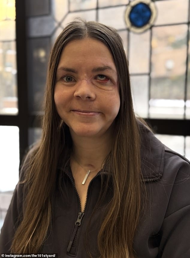 Alaska Mother Survives Bear Attack With Severe Spinal And Brain Injuries