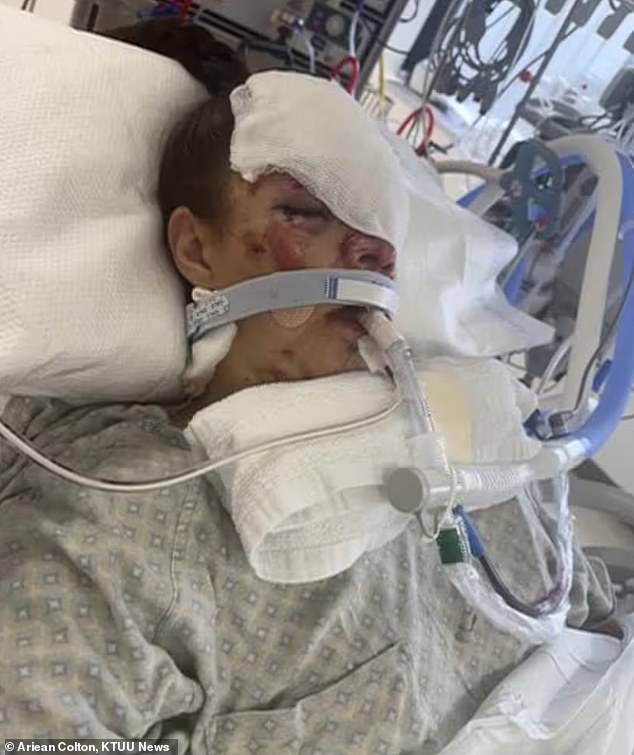 Kenai mother reveals devastating injuries eight months after bear mauling