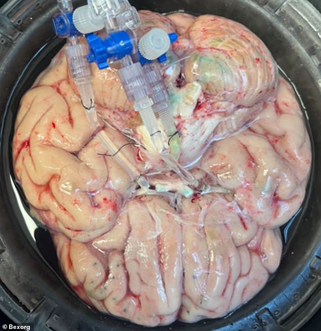 Connecticut startup tests new drugs on deceased human brains
