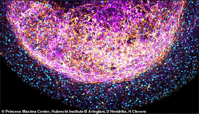 Connecticut startup tests new drugs on deceased human brains