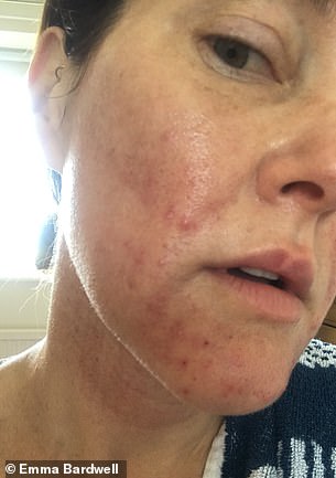 Emma Bardwell Overcomes Perimenopause Struggles to Reclaim Her Life