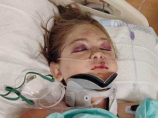 Idaho Mom Loses Both Legs After Devastating Tubing Accident at Bear Lake