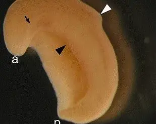 Ancient Worm Reveals Clues to Human Anus Evolution 550 Million Years Ago