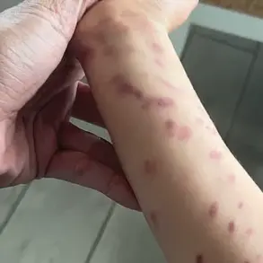 Octopus Attack at San Antonio Aquarium Injures Child and Sparks Safety Concerns