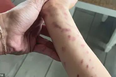 Octopus Attack at San Antonio Aquarium Injures Child and Sparks Safety Concerns