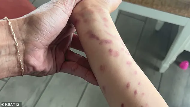 Octopus Attack at San Antonio Aquarium Injures Child and Sparks Safety Concerns